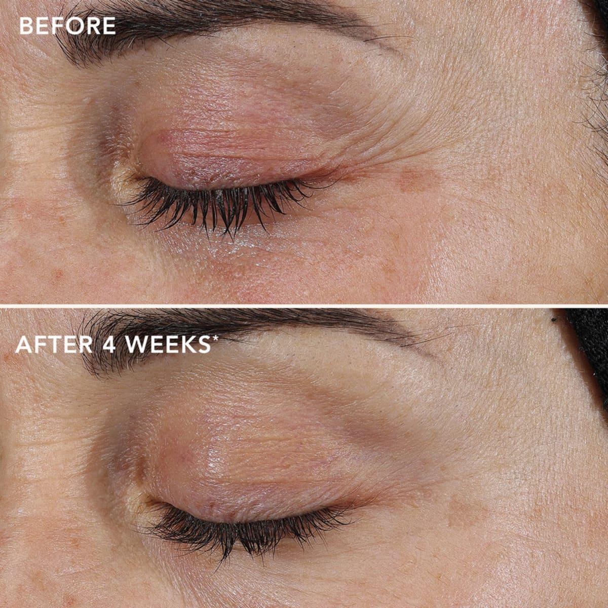 Вiдновлювальний крем з ретиноловим комплексом 0,3 % Image Skincare Ageless + Retinol Repair Crème 0.3 %, 50 г